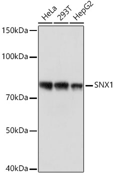 SNX1 Rabbit mAb