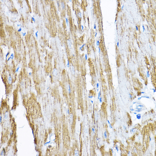 SAMM50 Rabbit polyclonal antibody