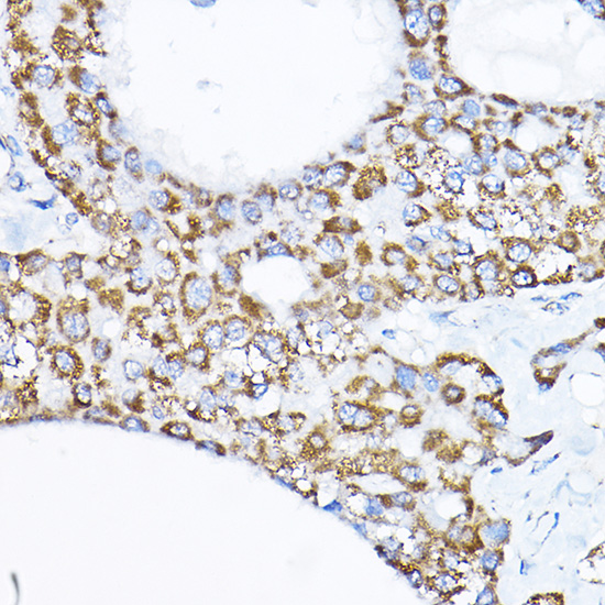 SAMM50 Rabbit polyclonal antibody