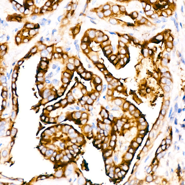 Thyroglobulin Rabbit monoclonal antibody