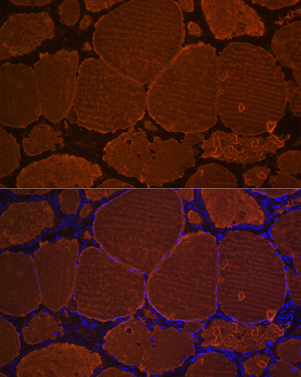 Thyroglobulin Rabbit monoclonal antibody