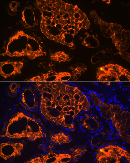 Thyroglobulin Rabbit monoclonal antibody