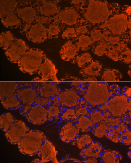 Thyroglobulin Rabbit monoclonal antibody
