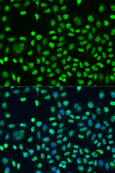 STAU2 Rabbit polyclonal antibody