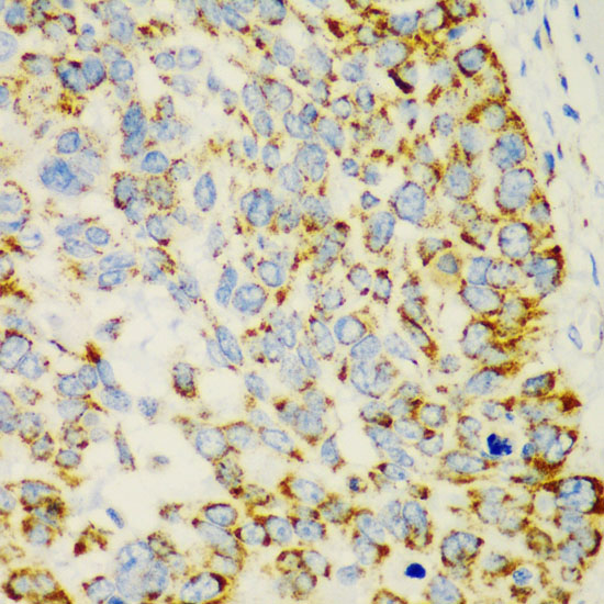 CHIA Rabbit polyclonal antibody