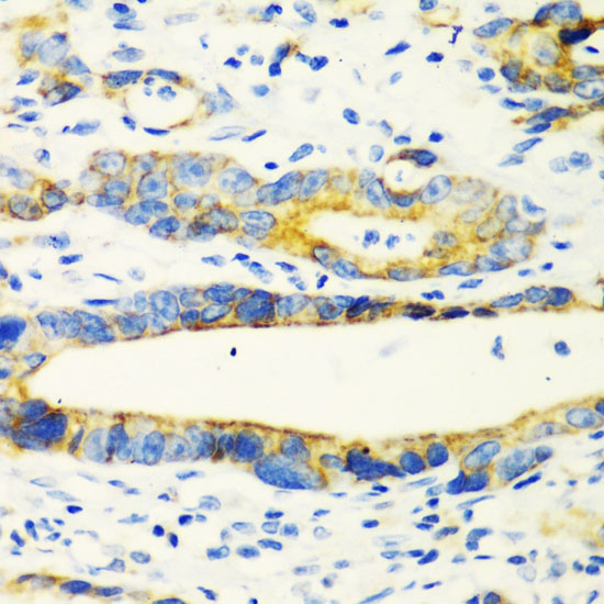CHIA Rabbit polyclonal antibody