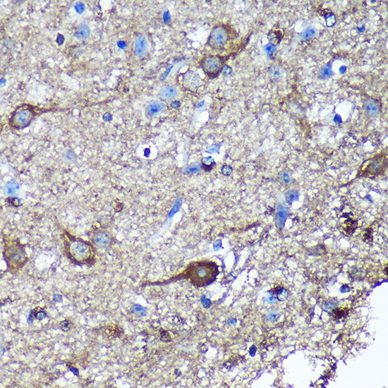 GULP1 Rabbit polyclonal antibody