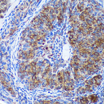 GULP1 Rabbit polyclonal antibody