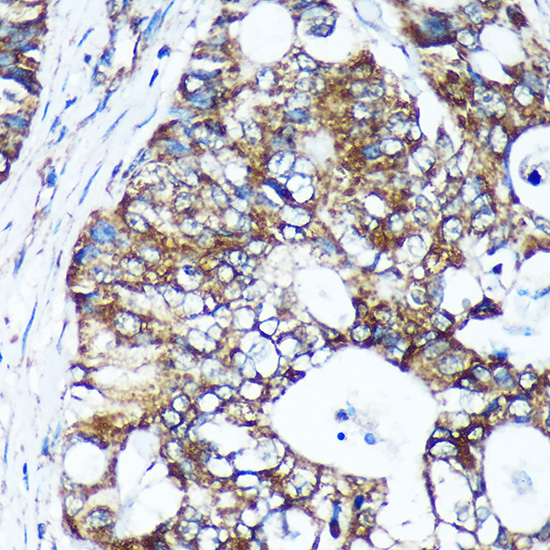 GULP1 Rabbit polyclonal antibody