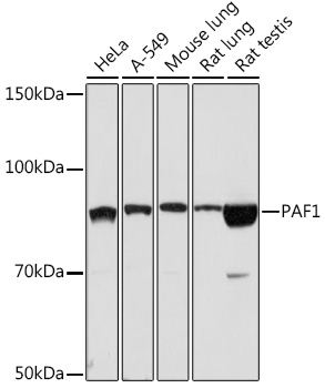 PAF1 Rabbit monoclonal antibody