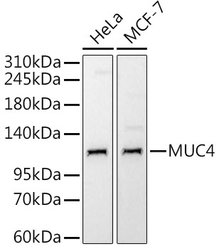 MUC4 Rabbit monoclonal antibody