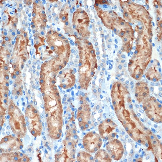 MUC4 Rabbit monoclonal antibody