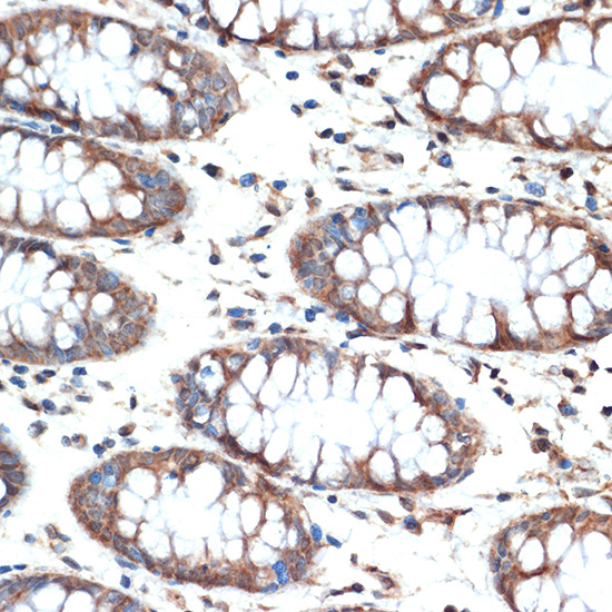 MUC4 Rabbit monoclonal antibody