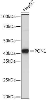 PON1 Rabbit monoclonal antibody