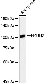 NSUN2 Rabbit polyclonal antibody