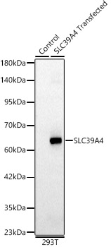 SLC39A4 Rabbit polyclonal antibody