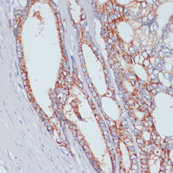 SLC39A4 Rabbit polyclonal antibody