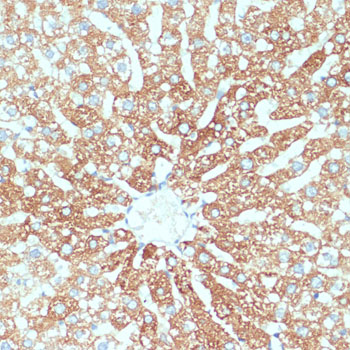 SLC39A4 Rabbit polyclonal antibody