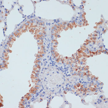 SLC39A4 Rabbit polyclonal antibody