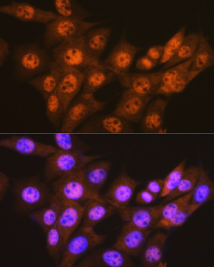 PSMA1 Rabbit monoclonal antibody