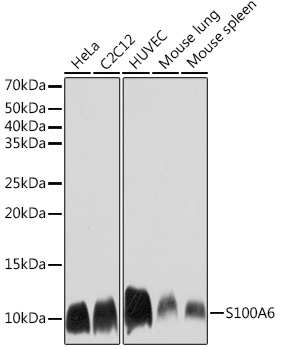 S100A6 Rabbit monoclonal antibody