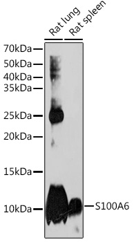 S100A6 Rabbit monoclonal antibody