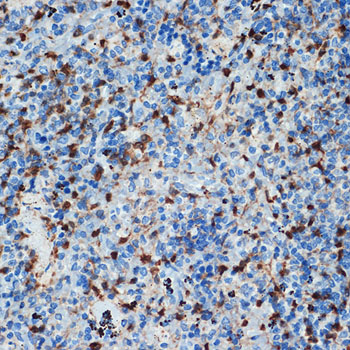 S100A6 Rabbit monoclonal antibody
