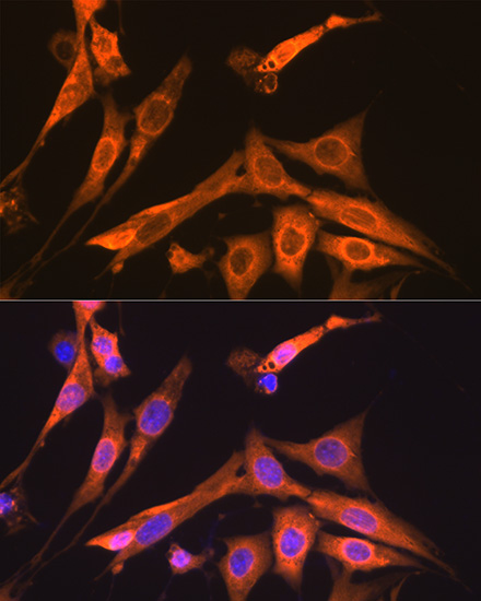 S100A6 Rabbit monoclonal antibody