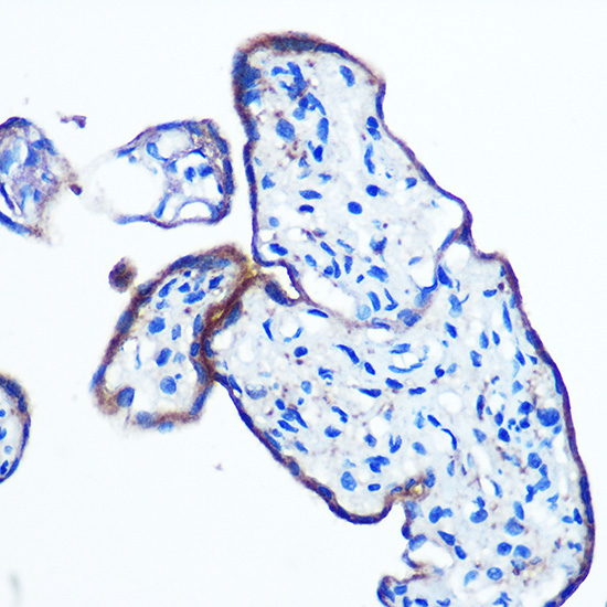 IKKE Epsilon Rabbit monoclonal antibody