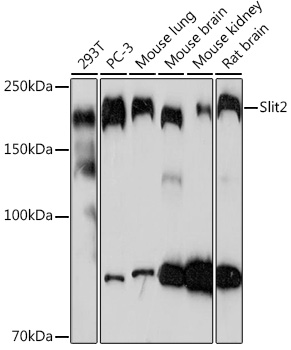 Slit2 Rabbit monoclonal antibody