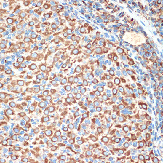 Slit2 Rabbit monoclonal antibody