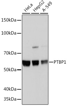 PTBP1 Rabbit monoclonal antibody