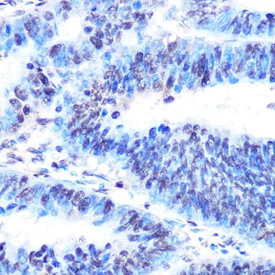 PTBP1 Rabbit monoclonal antibody