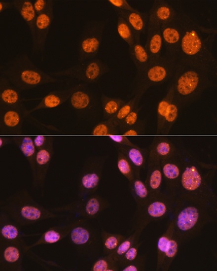 PTBP1 Rabbit monoclonal antibody