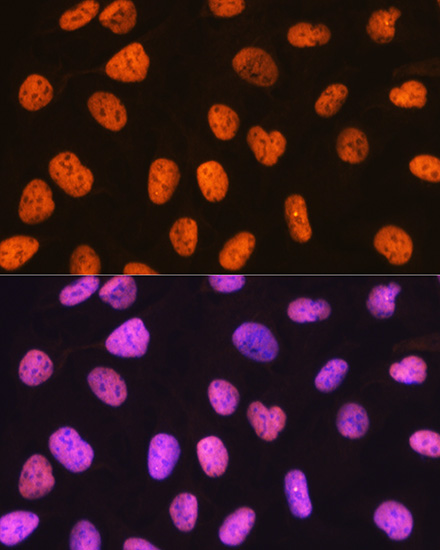 PTBP1 Rabbit monoclonal antibody