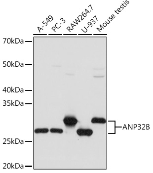 ANP32B Rabbit monoclonal antibody
