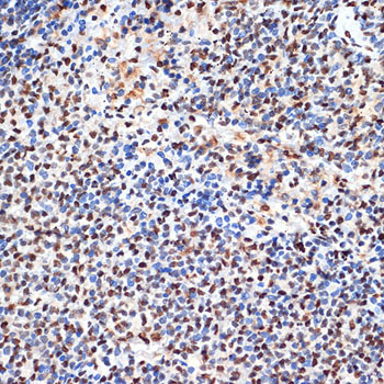 ANP32B Rabbit monoclonal antibody