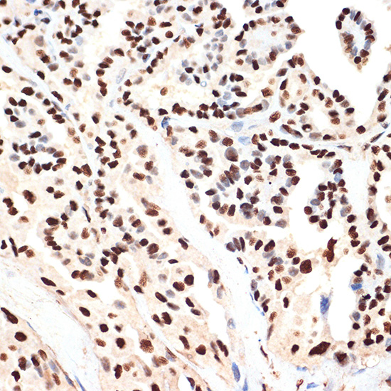 ANP32B Rabbit monoclonal antibody
