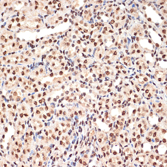ANP32B Rabbit monoclonal antibody