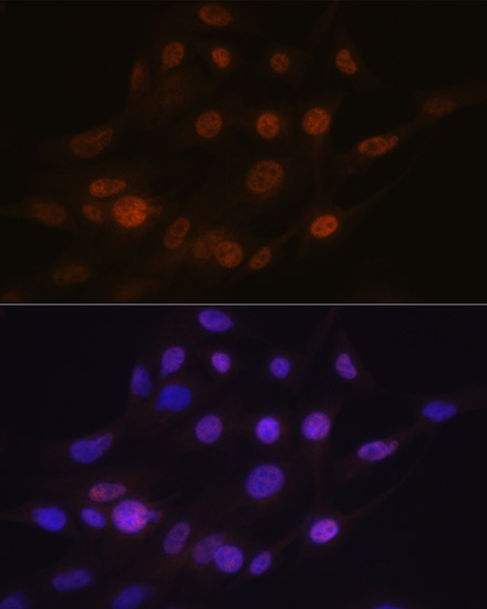 ANP32B Rabbit monoclonal antibody
