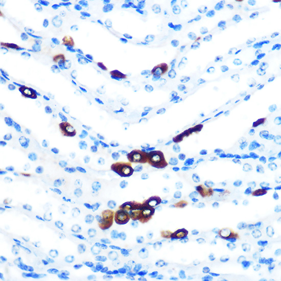 PIWIL1 Rabbit monoclonal antibody