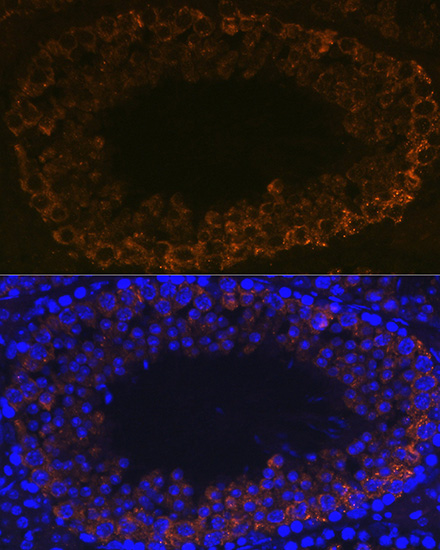 PIWIL1 Rabbit monoclonal antibody