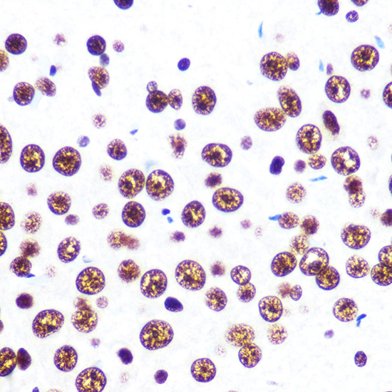 SFPQ Rabbit monoclonal antibody