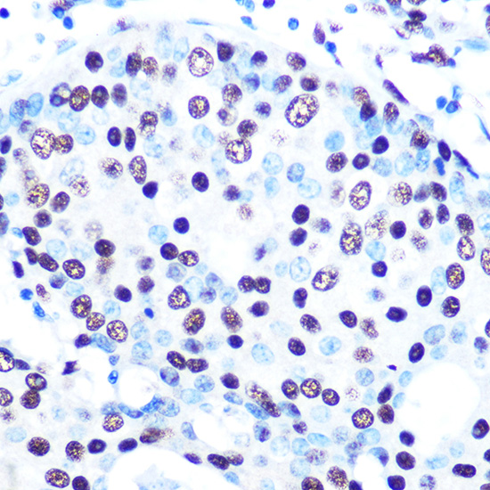 SFPQ Rabbit monoclonal antibody
