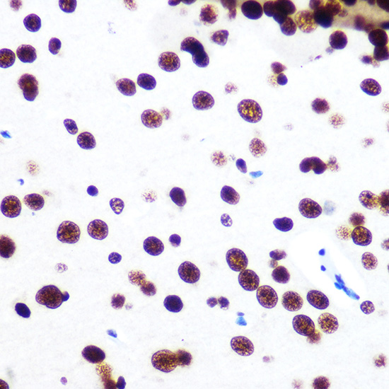 SFPQ Rabbit monoclonal antibody
