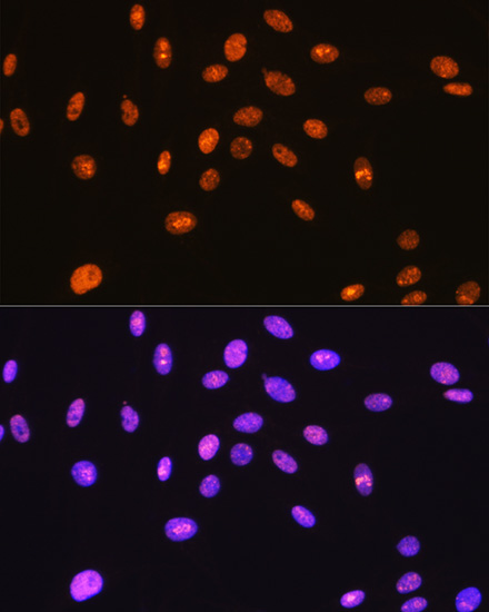 SFPQ Rabbit monoclonal antibody