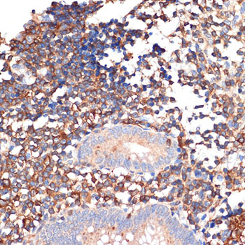 EHD1 Rabbit monoclonal antibody