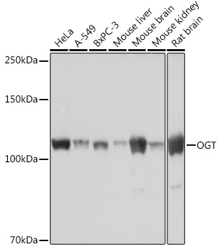 OGT Rabbit monoclonal antibody