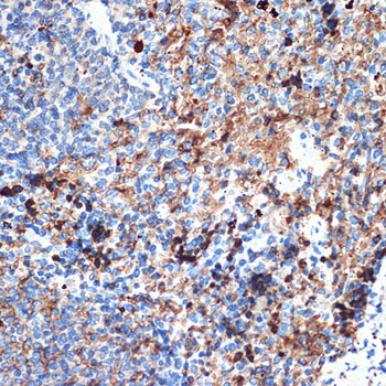 CRMP5/DPYSL5 Rabbit monoclonal antibody
