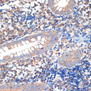 CRMP5/DPYSL5 Rabbit monoclonal antibody